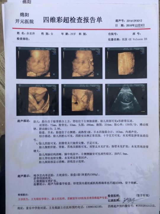 泰安漏诊畸形儿,产检正常却生出畸形儿