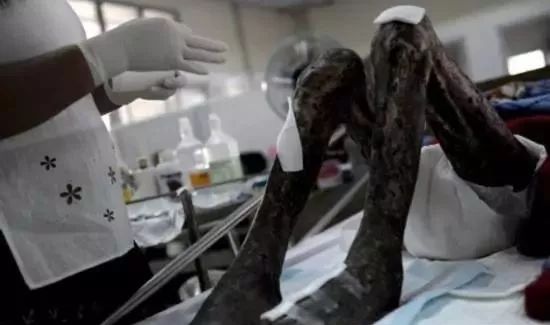这里租妻合法，艾滋指数全球第一，每年竟还有3000万人要去...
