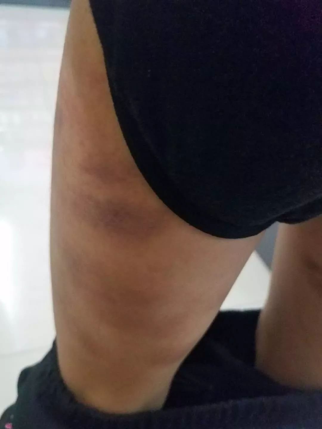 女童遭家暴送医后死亡,河源女婴被爸爸暴打