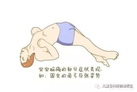 脑瘫孩子都是早产儿造成的吗,脑瘫的人智力正常吗