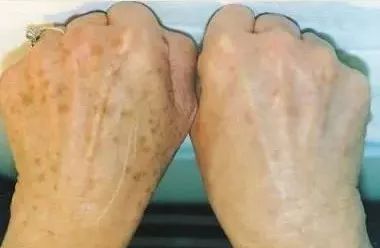 夏天被粉红色泡泡承包，嫁给爱情的女孩脸上都挂着糖霜