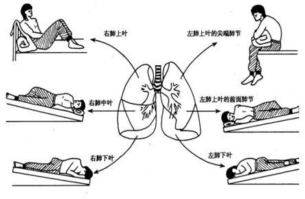 轻度呼吸功能障碍怎么样治疗,呼吸功能障碍的康复治疗
