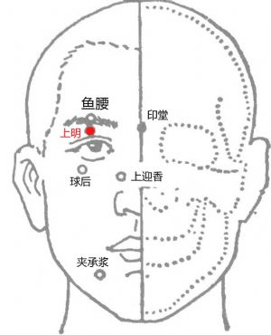 四明穴小儿推拿,中医推拿调理儿童近视的手法