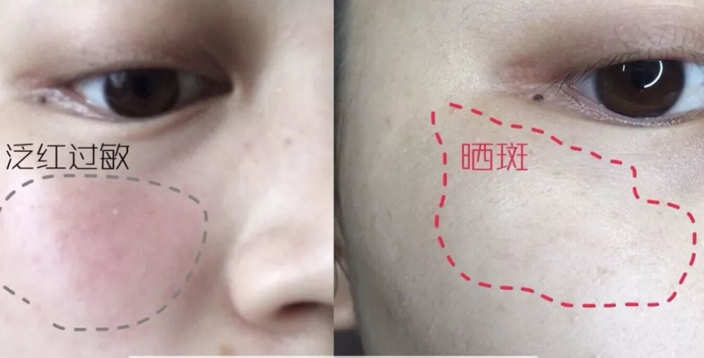 有必要用哪一款水乳,一辈子就能用一套水乳