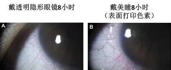 “日本制造”又曝丑闻！违禁成分泛滥，却还有1亿中国人疯抢