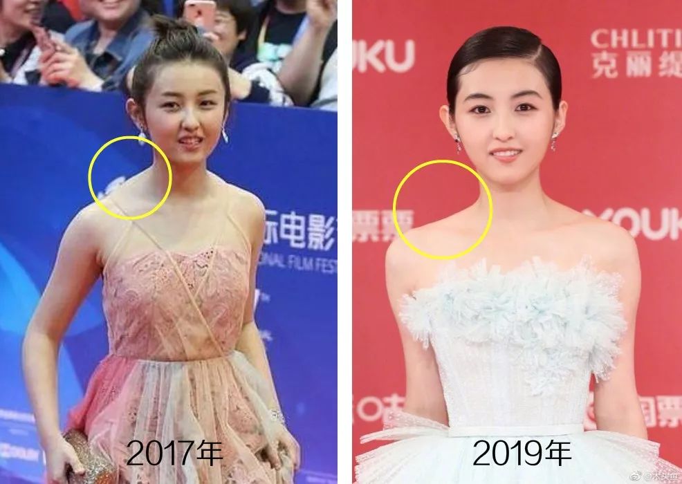 童星逆袭式长大后的样子,童星逆袭到世界冠军