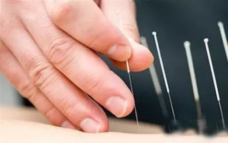 脾虚反酸嗳气烧心如何调理,治疗烧心反酸胃胀的千古经方