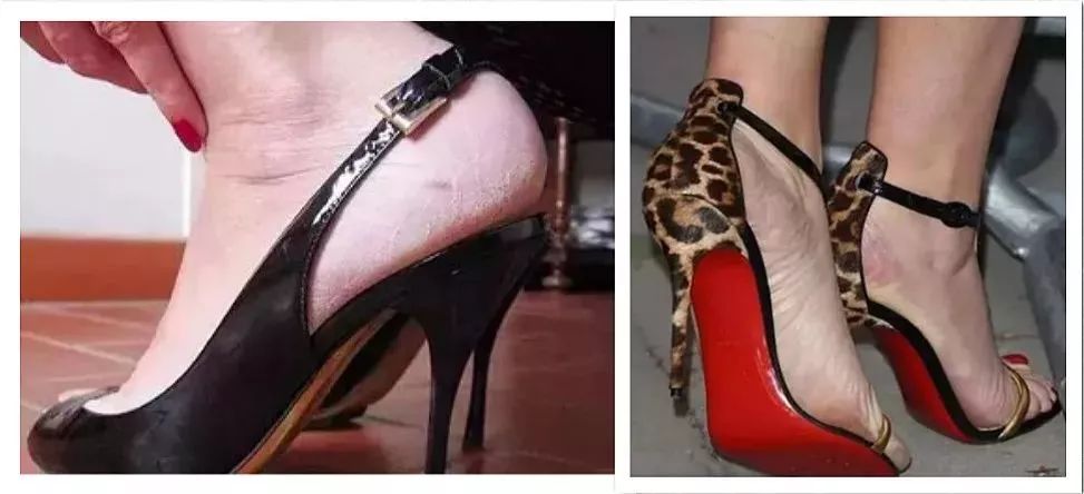 嫩脚神器告别死皮,脚死皮神器第一名