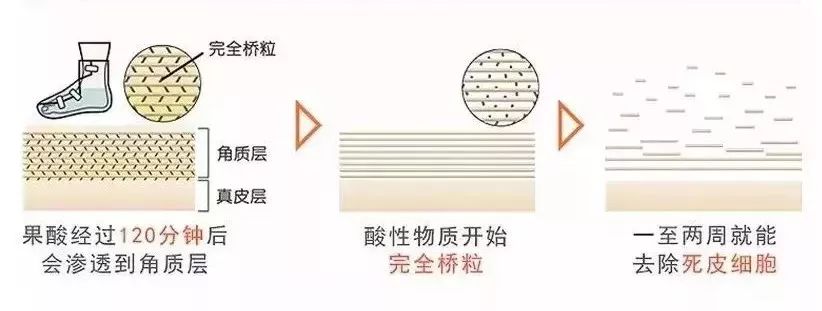 嫩脚神器告别死皮,脚死皮神器第一名