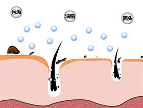 如何摆脱黑头反复的困扰才最有效,用黑头仪吸完黑头黑头还会再长吗