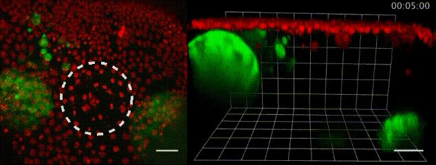人体脂肪能卖钱吗,人体脂肪摄入