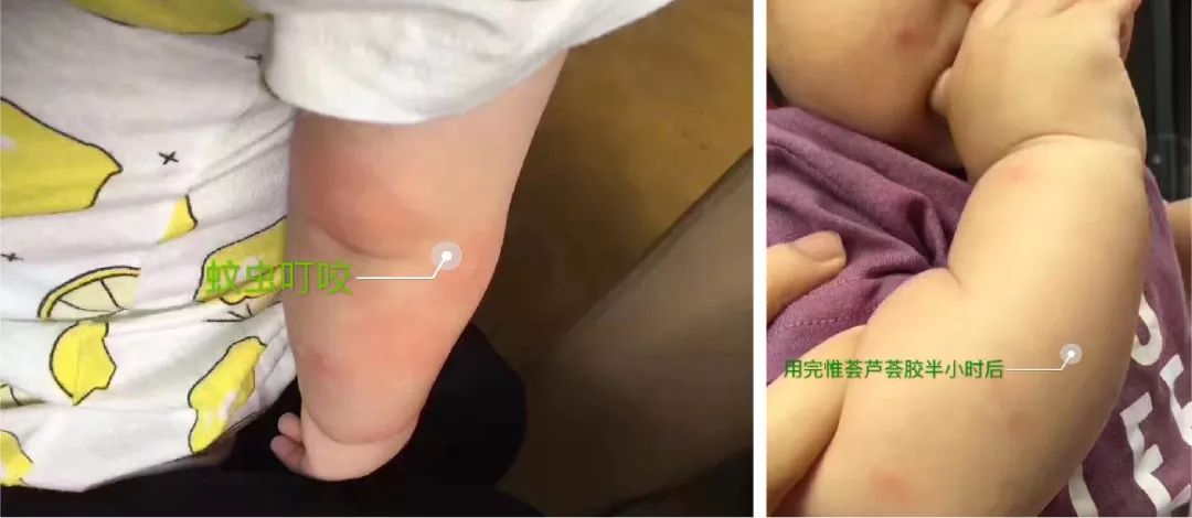 芦荟胶补水保湿提亮肤色晒后修复,祛痘晒后修复保湿补水芦荟胶