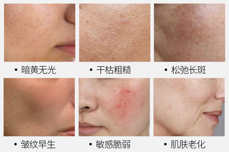 大长今金喜善宋慧乔,39岁宋慧乔完美复出御姐范十足