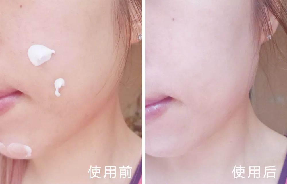 用它洗脸，脏东西自己浮出来，比做10次面膜还管用！丨开团