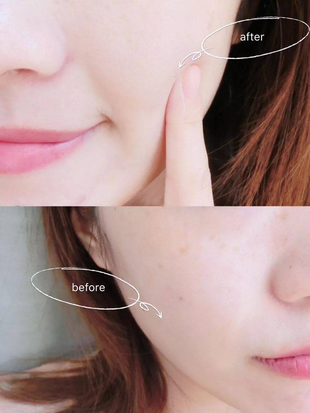 用它洗脸，脏东西自己浮出来，比做10次面膜还管用！丨开团