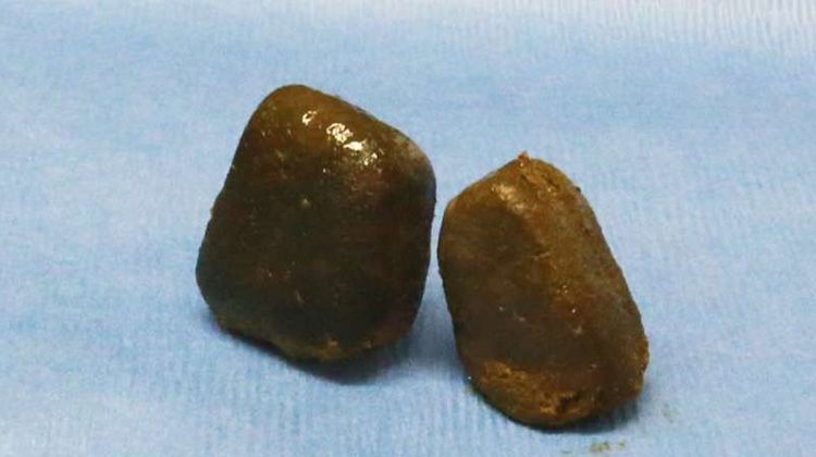 多吃披萨会怎么样,多吃pizza的好处