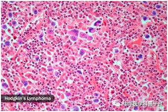 女人盗汗什么原因,盗汗失眠的原因