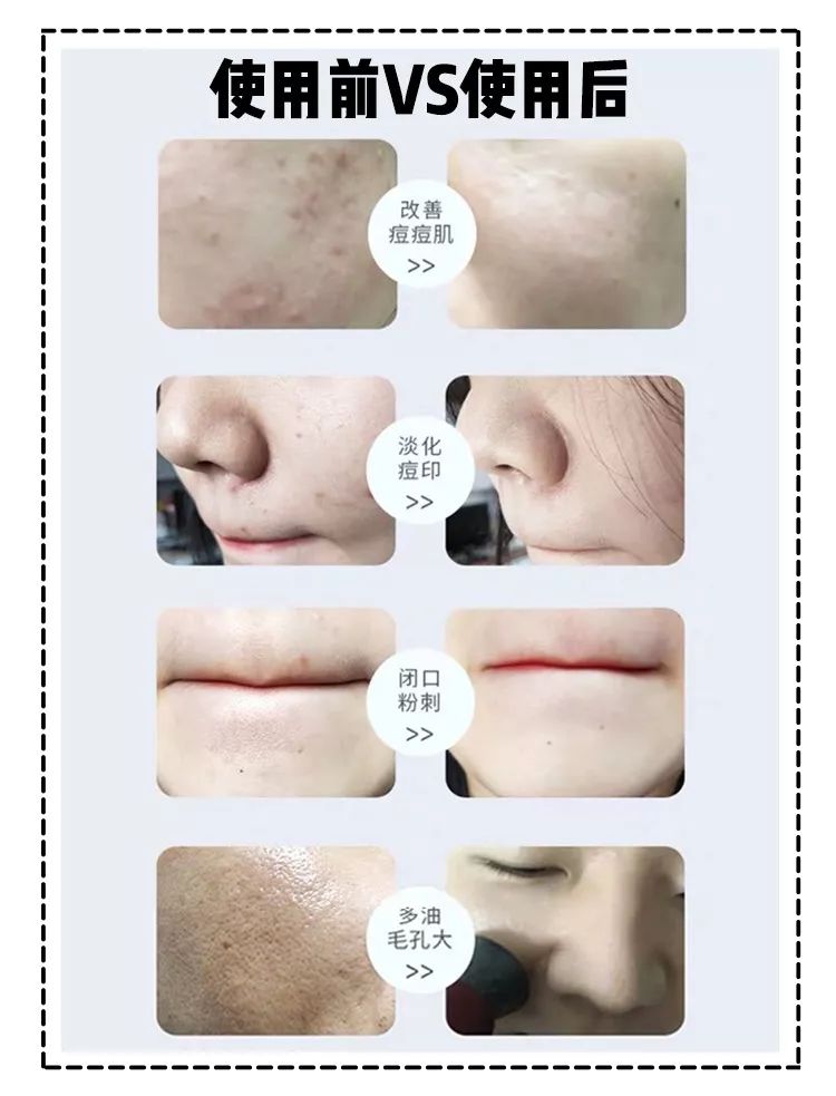 周冬雨17岁是什么样子,周冬雨17岁年轻时