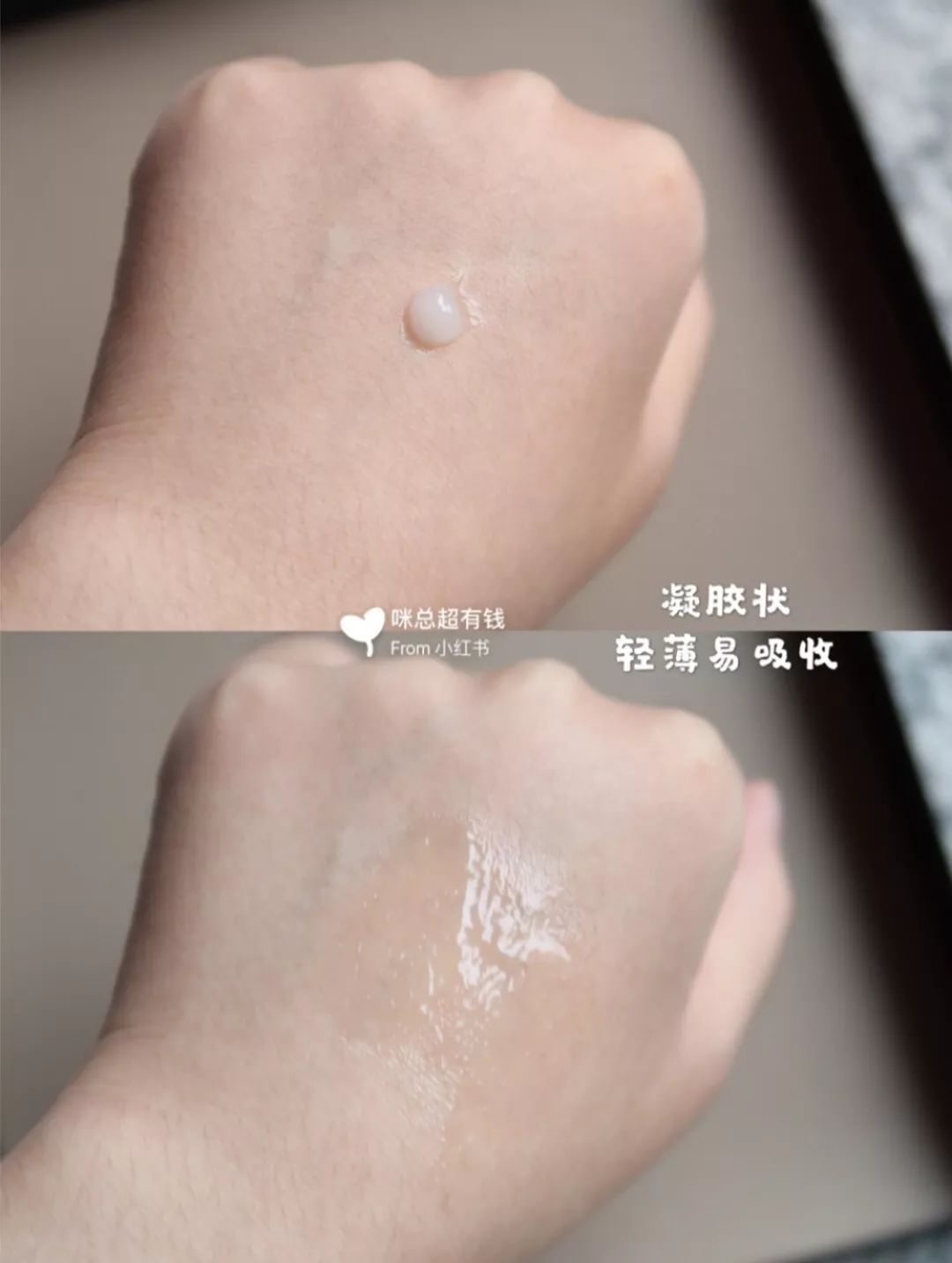 战痘总结,战痘十年是什么样子