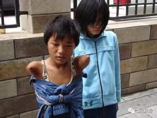 眼球被挖男孩案,孩子被拐走挖器官案例