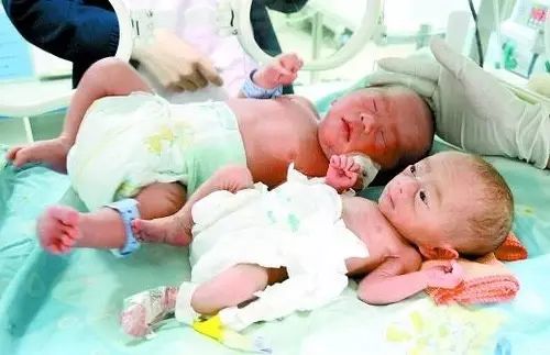 婴儿手脚畸形没查出来,新生儿手指畸形产检医院有责任么