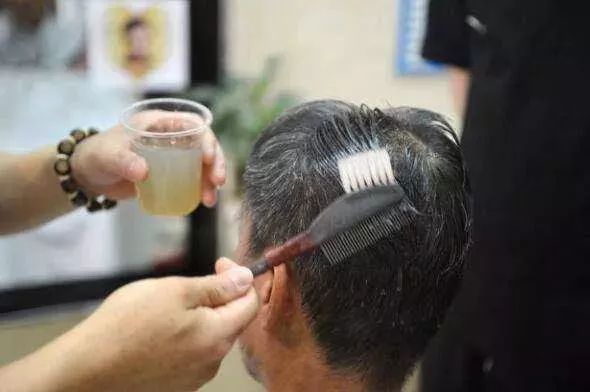 眼睛肿成缝，头皮溃烂…一周接诊20多例！年前干这事的荆门人要注意了