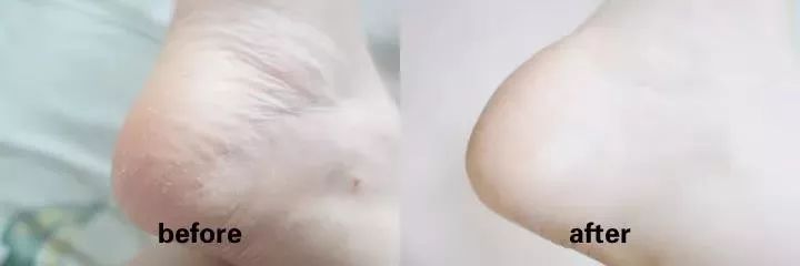 手部护理保养精油,spa护理手套