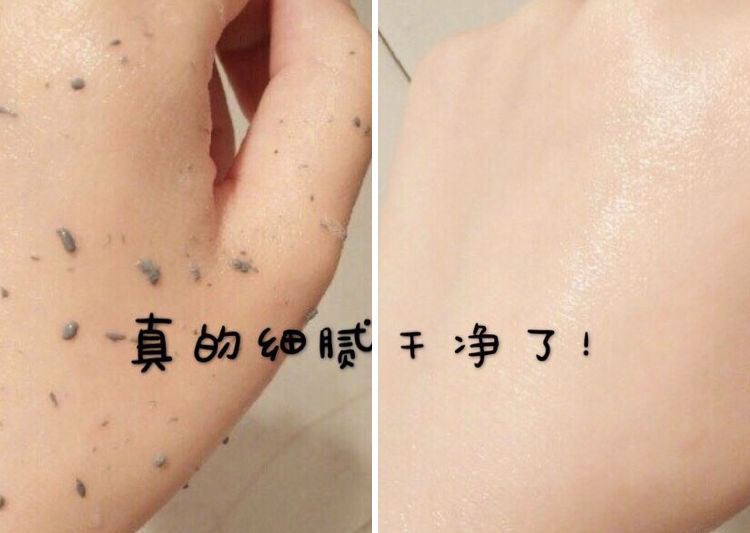 脸上搓下来很多泥,脸上搓出黑头