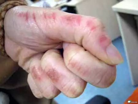 水产养殖纳米银在什么时候才能用,纳米银在水产上作用