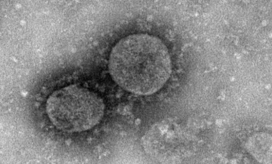 印尼确诊新冠超65万例,印尼疫情最新确诊人数