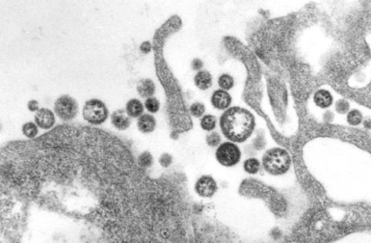 战疫史志⑱医学进步启示录｜P4实验室：大自然魔鬼的“囚室”病毒研究的“航母”