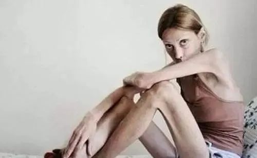 轻断食会得厌食症还是暴食症,厌食症暴食症前期有什么预兆