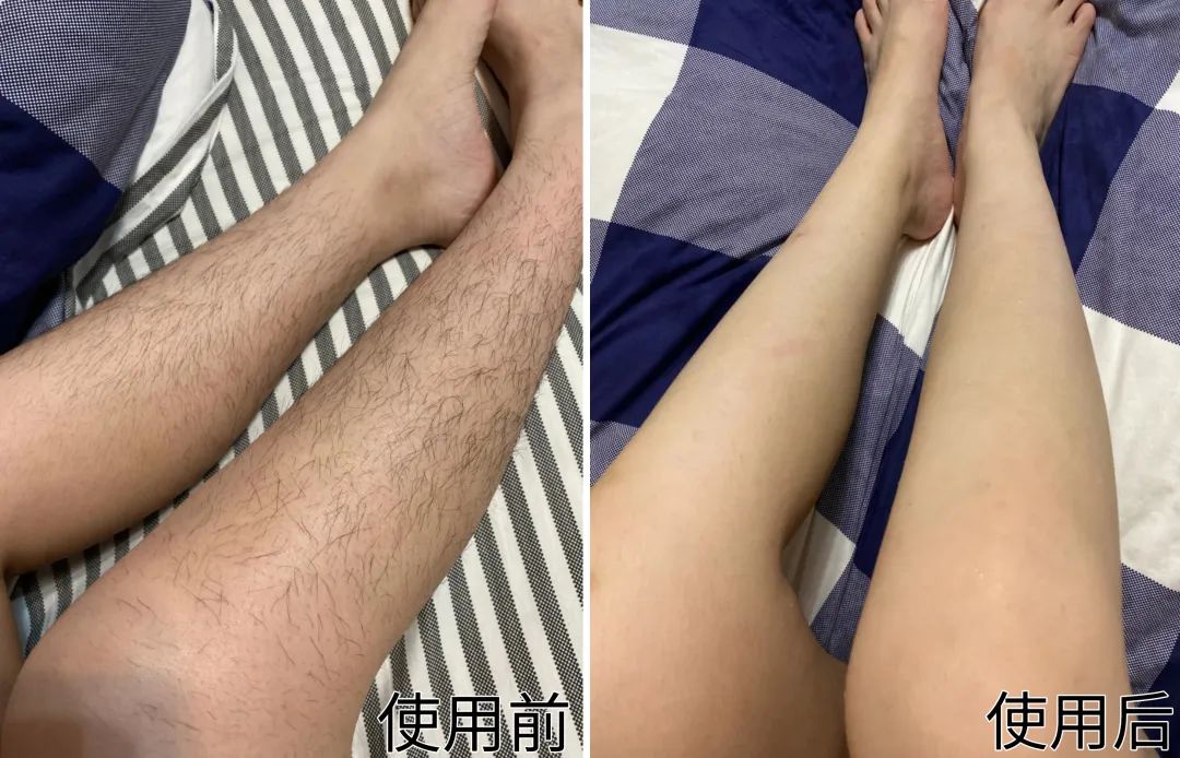光滑无暇|黑丑的“毛裤腿”，用它，10分钟“脱”得一干二净，肌肤光滑细腻