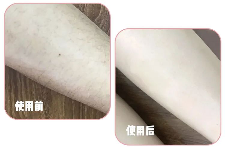 正品不刺激皮肤脱毛膏,猕猴桃脱毛膏哪种最好