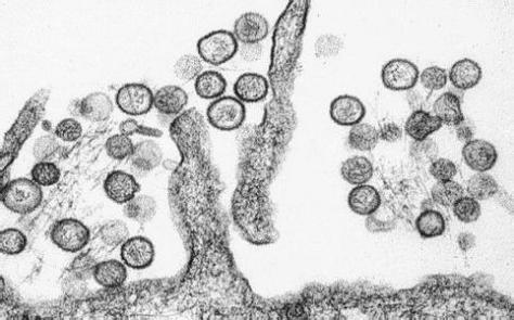 老鼠防治快速灭鼠,老鼠的习性与灭鼠方法