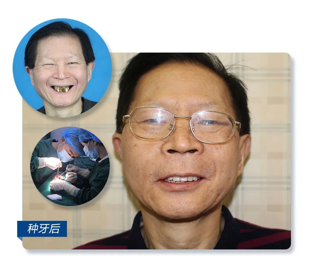 年轻牙齿掉光是什么因果,年轻人牙齿全部一次性掉光