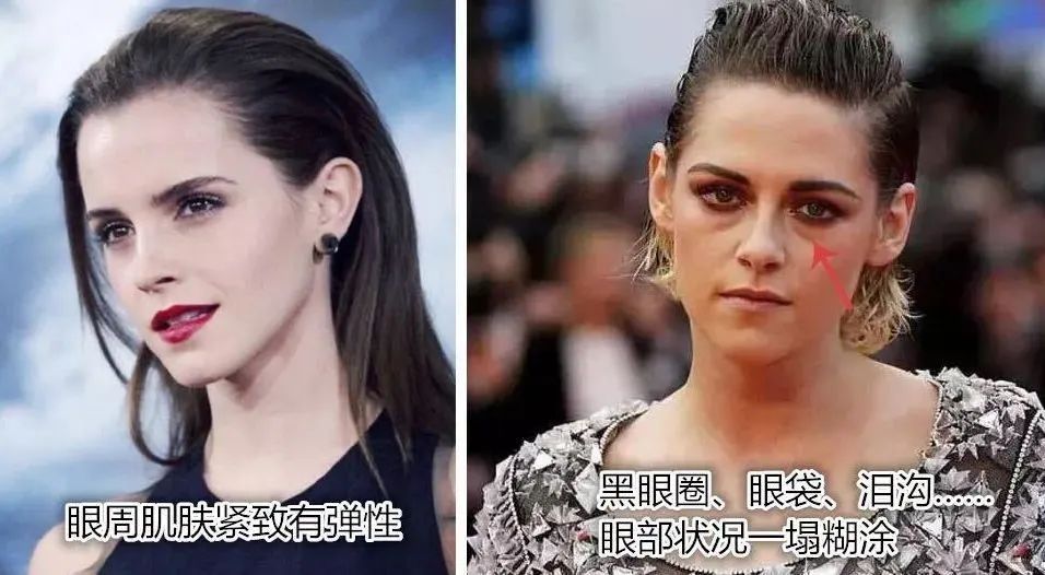 60岁没眼袋方法,教你一招去眼纹