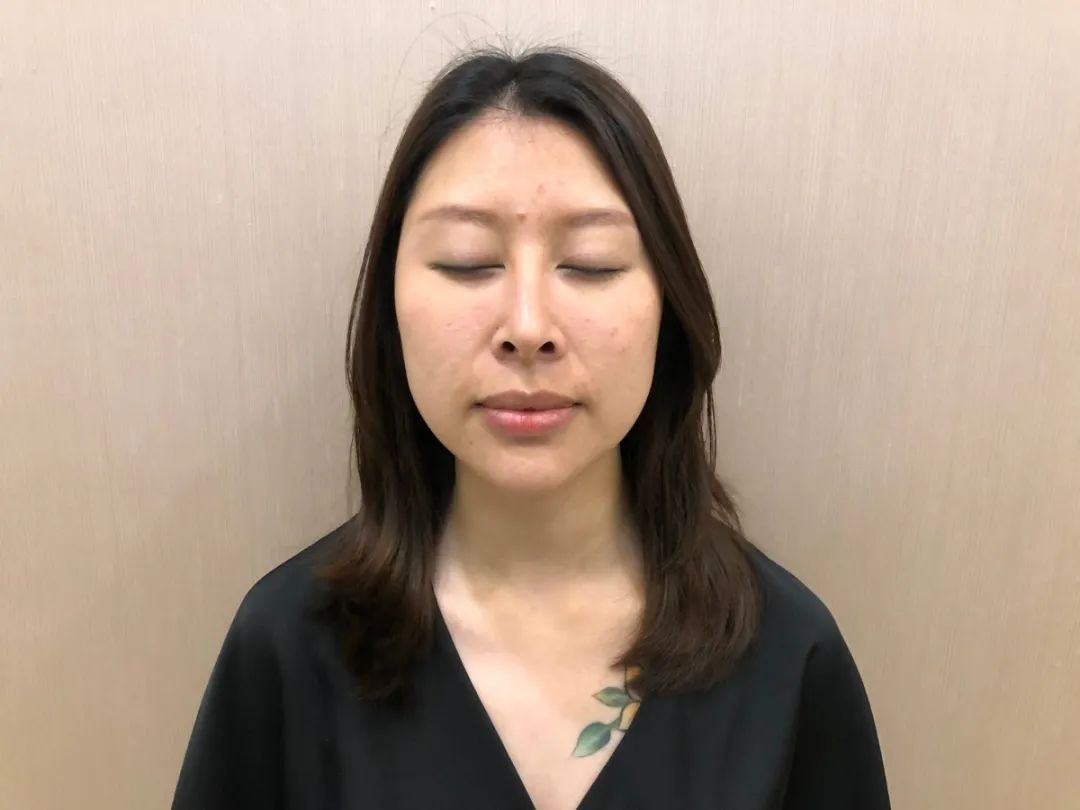 网红热玛吉效果怎么样,成都妹子素颜