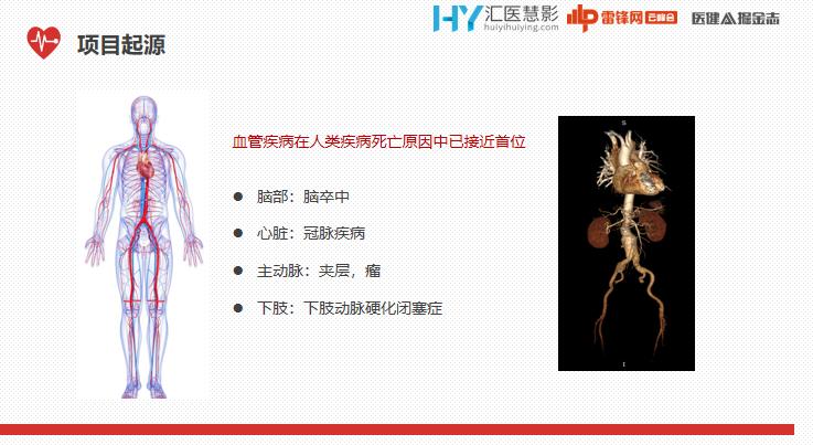 ai辅助医生心血管疾病诊断效力,ai技术治疗心血管疾病
