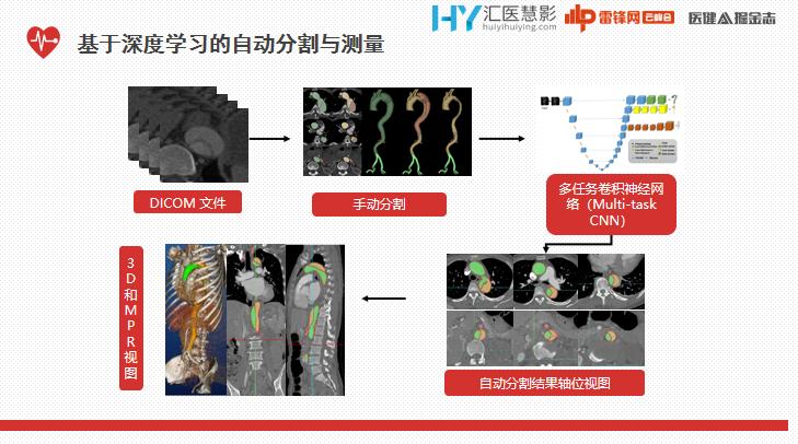 ai辅助医生心血管疾病诊断效力,ai技术治疗心血管疾病