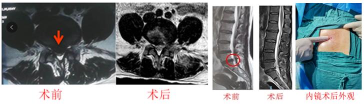筋骨堂治疗视频,筋骨堂治疗效果怎么样