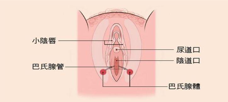 巴氏腺囊肿能不能自愈,女性巴氏腺囊肿是什么原因造成的