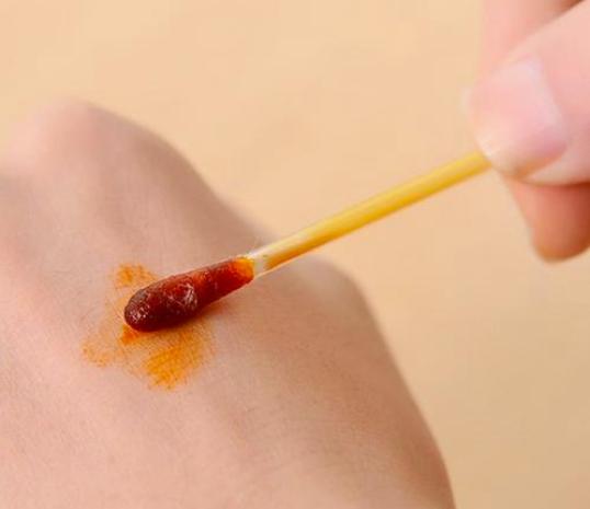 常用于皮肤消毒剂有哪些浓度多少,常用的皮肤消毒剂有哪些