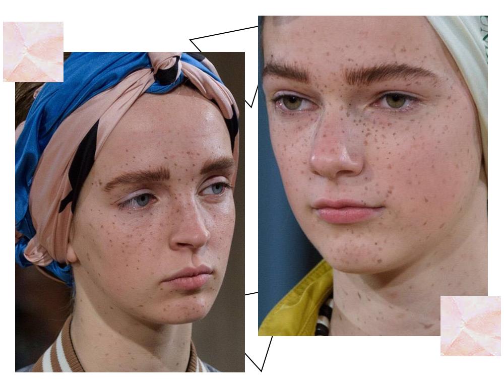 爱长斑的女人怎么办,女生长斑