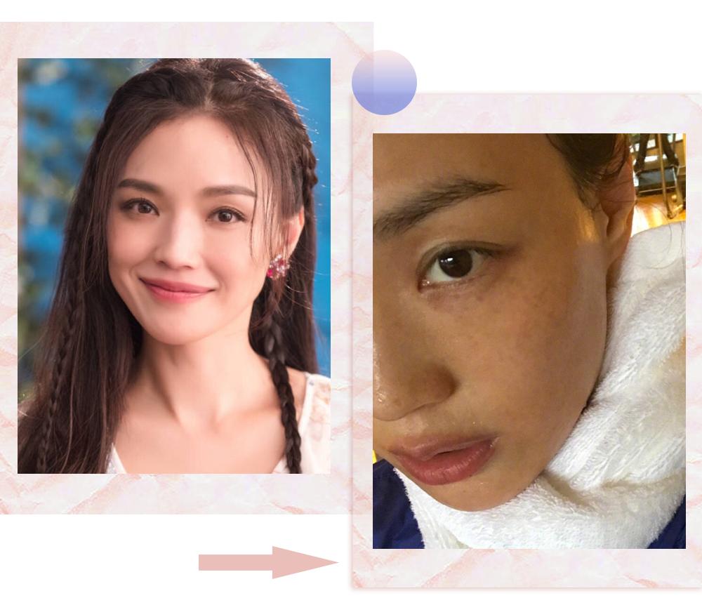 爱长斑的女人怎么办,女生长斑