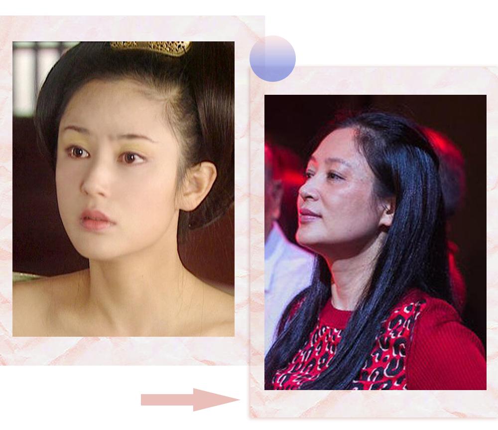 爱长斑的女人怎么办,女生长斑