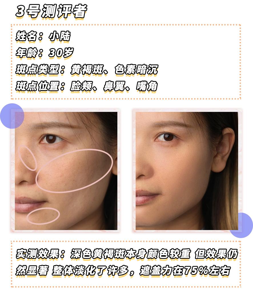 爱长斑的女人怎么办,女生长斑