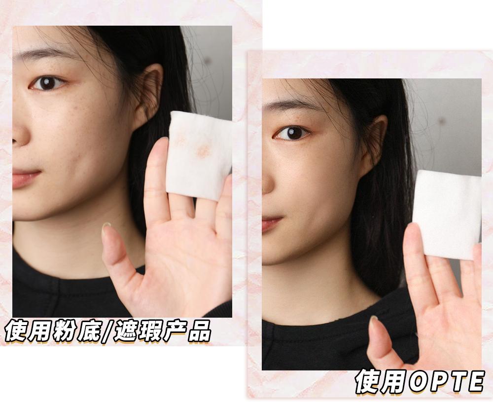 爱长斑的女人怎么办,女生长斑