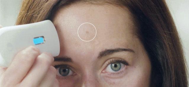 爱长斑的女人怎么办,女生长斑