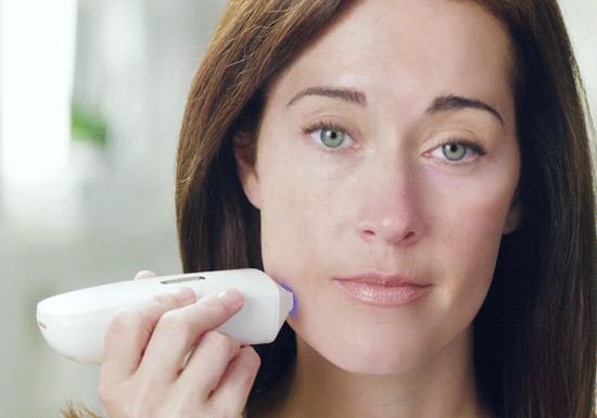 爱长斑的女人怎么办,女生长斑